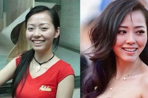 明星整容失败案例：张靓颖、郑爽等失去自然美